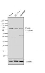 PIAS1 Monoclonal Antibody (ZP008)