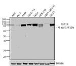 IGF1R beta Monoclonal Antibody (ZI001)