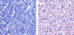 PAX5 Antibody in Immunohistochemistry (Paraffin) (IHC (P))