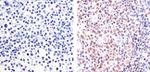 PAX5 Antibody in Immunohistochemistry (Paraffin) (IHC (P))