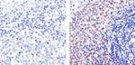 PAX5 Antibody in Immunohistochemistry (Paraffin) (IHC (P))