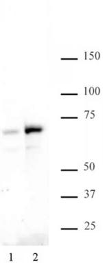 Phospho-NFkB p65 (Ser529) Antibody in Western Blot (WB)
