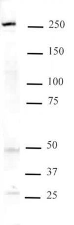 Mi-2 beta Antibody in Western Blot (WB)