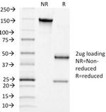 Luteinizing Hormone/Choriogonadotropin Receptor (LHCGR) Monoclonal Antibody (LHCGR/1415)