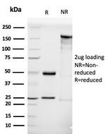 Luteinizing Hormone/Choriogonadotropin Receptor (LHCGR) Monoclonal Antibody (LHCGR/1416)