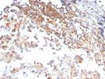 Luteinizing Hormone/Choriogonadotropin Receptor (LHCGR) Monoclonal Antibody (LHCGR/7399)