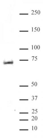 Phospho-MeCP2 (Ser80) Antibody in Western Blot (WB)