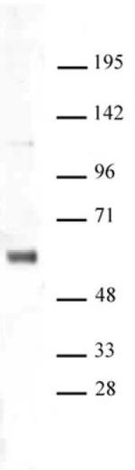 SNF5 Antibody in Western Blot (WB)
