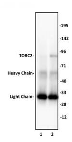 TORC2 Antibody in Immunoprecipitation (IP)