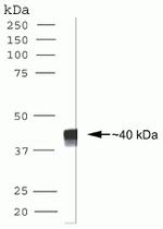 CDX2 Monoclonal Antibody (ZC007)