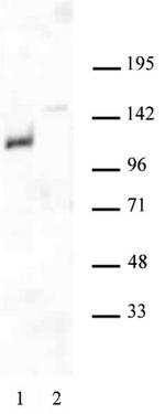 Androgen Receptor Antibody in Western Blot (WB)