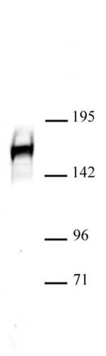 Drosha Antibody in Western Blot (WB)