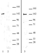 HDAC9 Antibody in Western Blot (WB)
