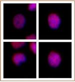 MEIS 1/2/3 Antibody in Immunocytochemistry (ICC/IF)
