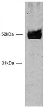 HNF-3 beta / FOXA2 Antibody in Western Blot (WB)
