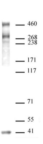 SMRT / NCoR2 Antibody in Western Blot (WB)