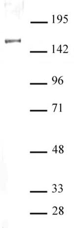 SIN3A Antibody in Western Blot (WB)
