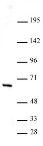 HDAC1 Antibody in Western Blot (WB)