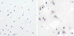 GSK3B Monoclonal Antibody (ZG004)