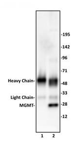 MGMT Antibody in Immunoprecipitation (IP)