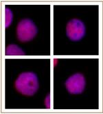 CAF-1 p60 Antibody in Immunocytochemistry (ICC/IF)