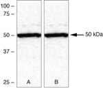 TXNIP Polyclonal Antibody