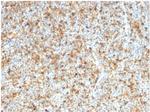LMO2 (B-Cell Marker) Monoclonal Antibody (LMO2/1972)