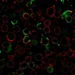 LMO2 Recombinant Rabbit Monoclonal Antibody (LMO2, 3147R)