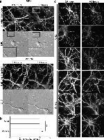 beta Amyloid Antibody in Immunocytochemistry (ICC/IF)
