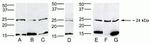 HOXB7 Polyclonal Antibody