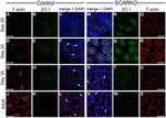 ZO-1 Antibody in Immunohistochemistry (IHC)
