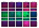 ZO-1 Antibody in Immunohistochemistry (IHC)