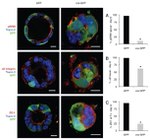 ZO-1 Antibody in Immunohistochemistry (IHC)