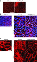 ZO-1 Antibody in Immunocytochemistry (ICC/IF)