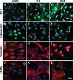 ZO-1 Antibody in Immunocytochemistry (ICC/IF)