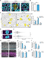 ZO-1 Antibody in Immunohistochemistry (IHC)