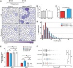 ZO-1 Antibody in Immunohistochemistry (IHC)