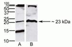 Claudin 8 Antibody in Western Blot (WB)