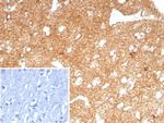 CD91/LDL Receptor Related Protein 1 (LRP1) Recombinant Rabbit Monoclonal Antibody (LRP1/8771R)
