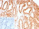 CD91/LDL Receptor Related Protein 1 (LRP1) Recombinant Rabbit Monoclonal Antibody (LRP1/8947R)