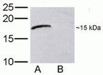 XTP4 Polyclonal Antibody