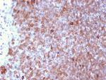 Lymphocyte Specific Protein 1 (LSP1)/pp52 Monoclonal Antibody (LSP1, 3025)