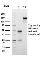 Lymphocyte Specific Protein 1 (LSP1)/pp52 Antibody in SDS-PAGE (SDS-PAGE)