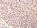 Lymphocyte Specific Protein 1 (LSP1)/pp52 Antibody in Immunohistochemistry (Paraffin) (IHC (P))