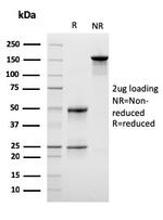 Lymphocyte Specific Protein 1 (LSP1)/pp52 Antibody in SDS-PAGE (SDS-PAGE)