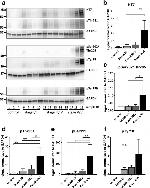 Tau Antibody in Western Blot (WB)