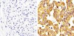 Metadherin Antibody in Immunohistochemistry (Paraffin) (IHC (P))