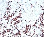 Lysozyme (Histiocytoma and Monocytic Acute Leukemia Marker) Monoclonal Antibody (LYZ/3943)