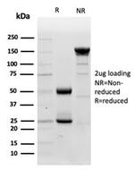 Lysozyme (Histiocytoma andMonocytic Acute Leukemia Marker) Antibody in SDS-PAGE (SDS-PAGE)