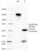 TACSTD2/TROP2 (Epithelial Marker) Antibody in SDS-PAGE (SDS-PAGE)